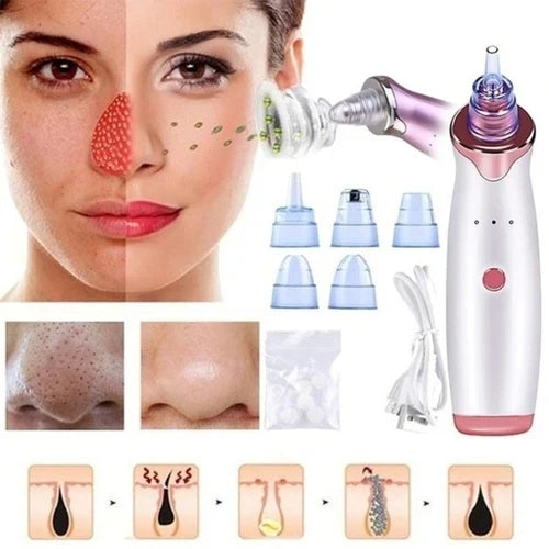 "GlowSkin™ Portable Blackhead Remover"